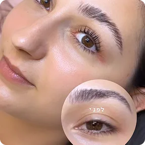 טיפול הרמת ריסים