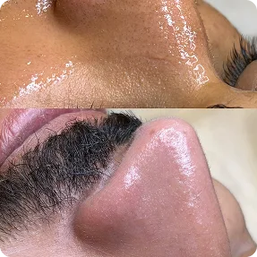 ניקוז קומודונים