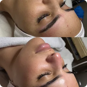 טיפול אנטי אייג׳ינג