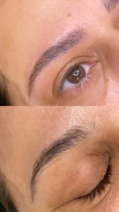 מיקרובליידינג