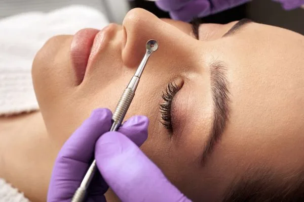 ניקוז קומודונים